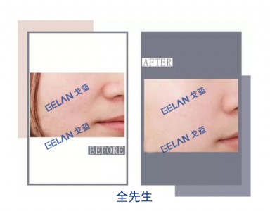 t(y)ĤNӹN Vݸ{(ln)